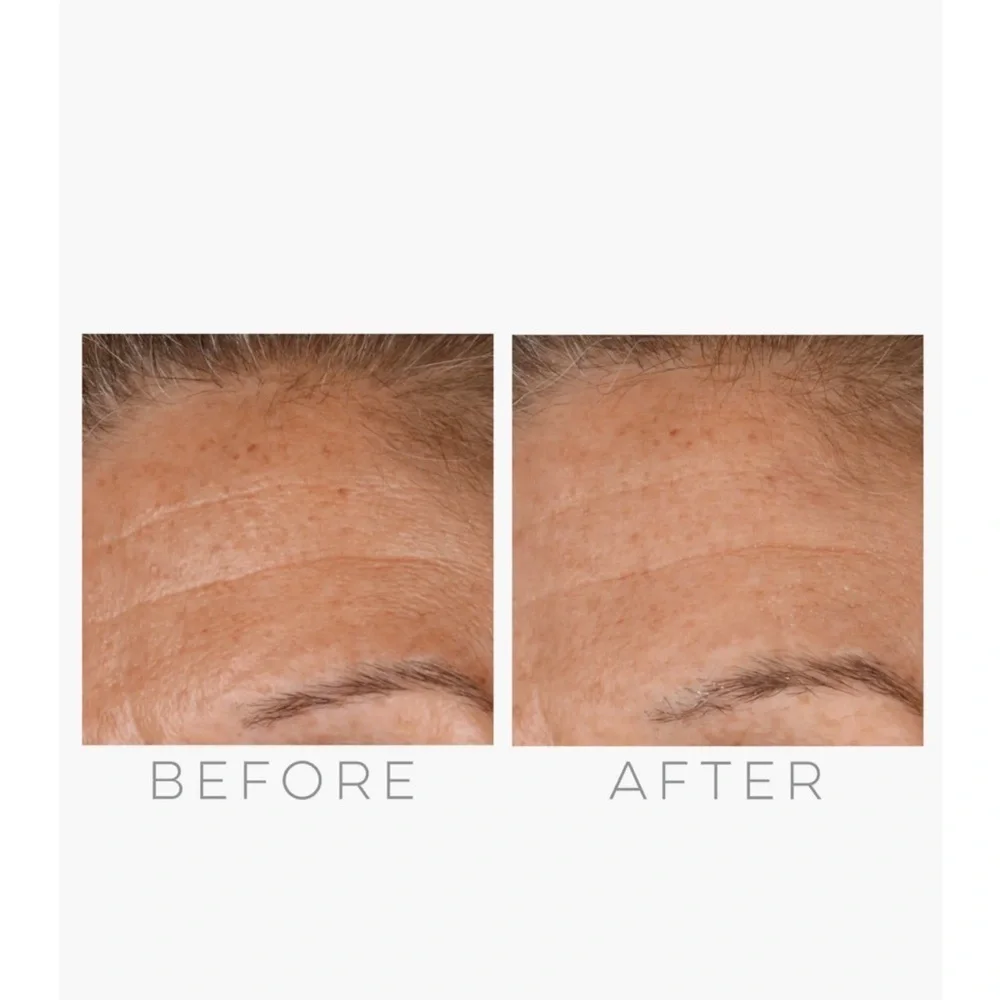 GloPro Skincare Tool -‎ White and Pink